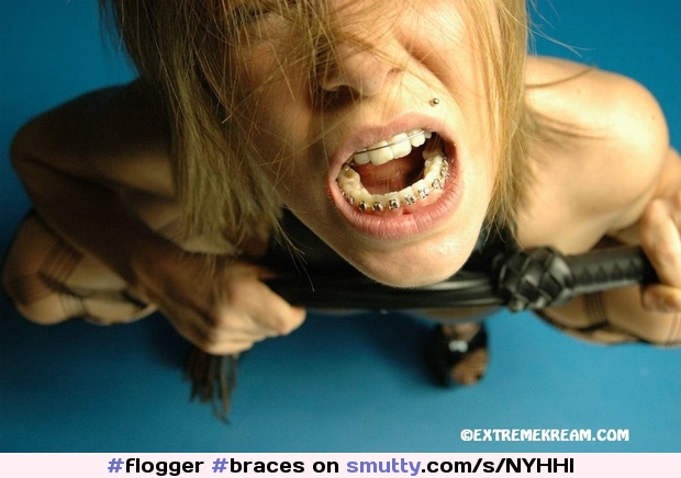 #braces #retainer #flogger