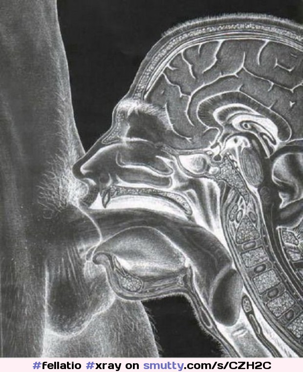 An image by Bioboy: Unauthorized use of the MRI machine | 
#fellatio #xray