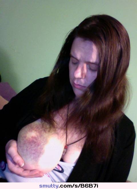 Bruised Breast  Leaving Marks - An image by: absence_of_light - Fantasti.cc
#bdsm#masochist#leaving marks#breast slapping#absence_of_light