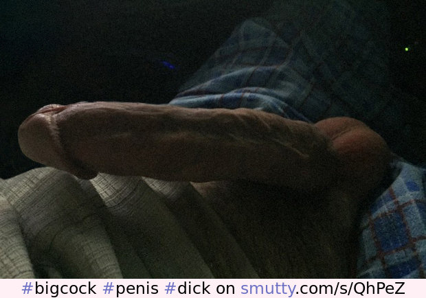 #bigcock#penis#dick#cock#glans#closeupcock#closeup#amateur#mushroom#mushroomhead#cockhead#erection#massivecock#massivedick#helmet#balls