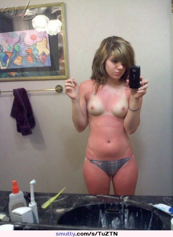 Selfie Topless Topless Bikini Sunburn Ouch