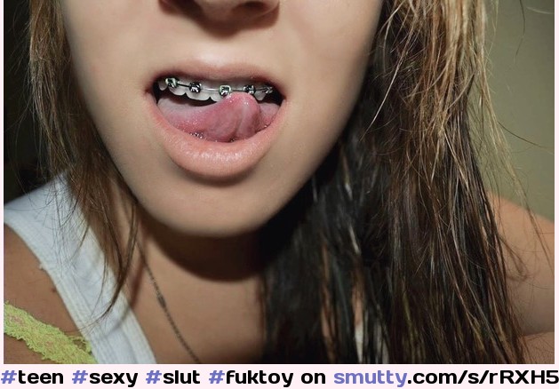 #teen#sexy#slut#fuktoy#braces