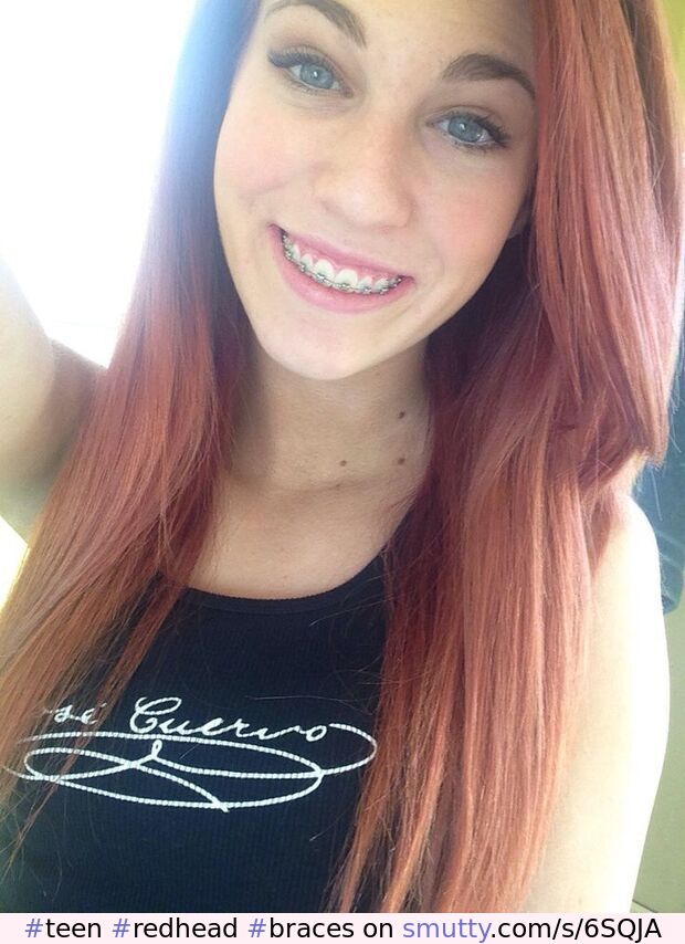 #teen #redhead #braces #smile #BraceFace #ginger #amateur #AmateurTeen #NonNude #nn #cute #CuteTeen