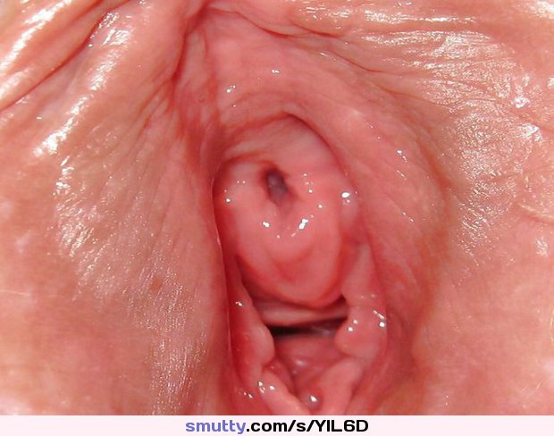 An Image By Sundark Exterior Opening Of A Girls Urethera Pee Hole To