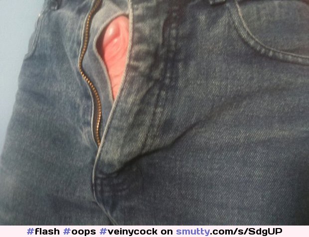 An image by The_num: Burst zip and going commando is a bad idea... | #flash #oops #veinycock