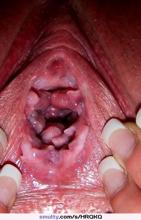 #pussy #extreme #heldopen #openpussy #opencunt #cunt #hardcore #nsfw #internal #vagina #gaping #stretched #stretchedpussy #stretchedcunt