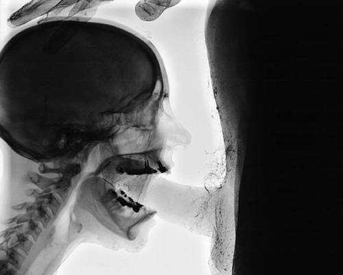 An image by Lovesponge:  an image from Lovesponge
#fellatio #xray